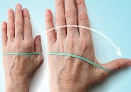 hand osteoarthritis