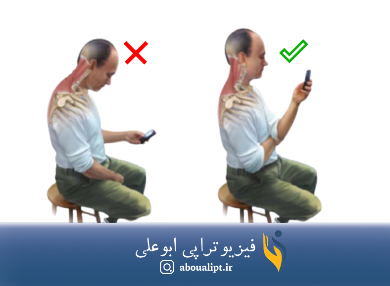 فردی بر روی صندلی یک بار با وضعیت صحیح گردن و در حالت دیگر با وضعیت نامناسب گردن نشسته است.